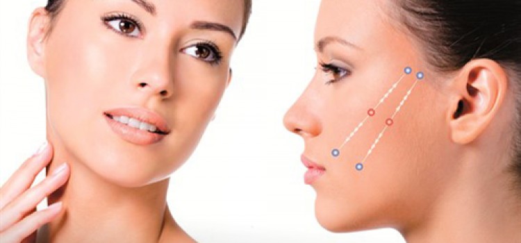 Rejuvenescimento Facial: Fio de Sustentação Mint Lift