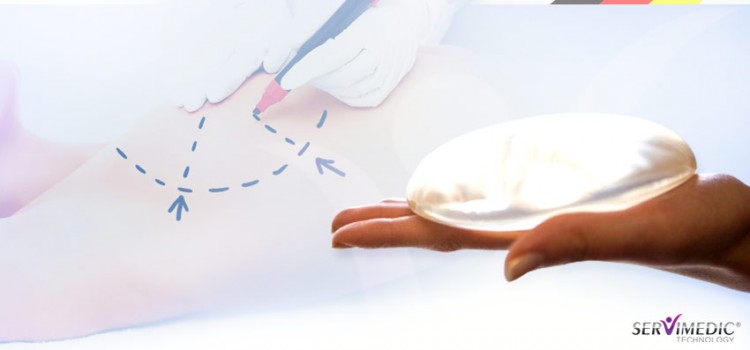 Prótese de silicone: tudo o que você precisa saber