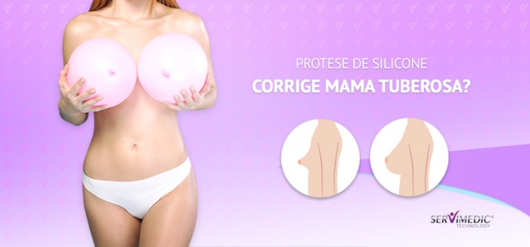 Prótese de Silicone Corrige Mama Tuberosa?