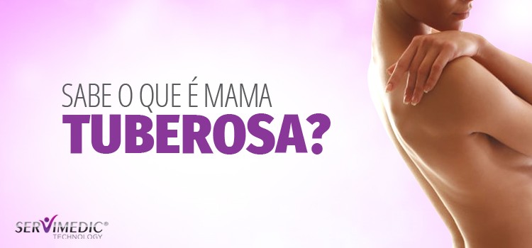 Sabe-o-Que-é-Mama-Tuberosa?