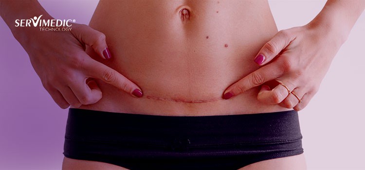 Cicatrização de cirurgia