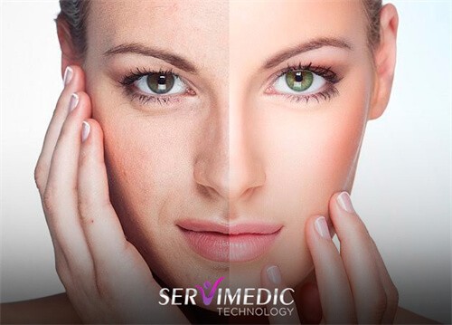 Aliado no Rejuvenescimento Facial Aliado no Rejuvenescimento Facial