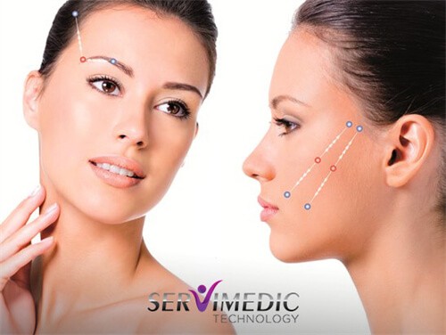 Rejuvenescimento Facial: Sutura Silhouette