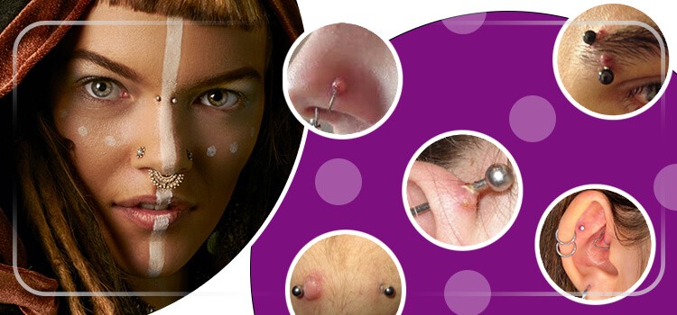 foto de varias pessoas com piercing e queloide