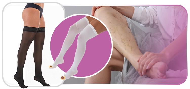 pessoas usando meia de compressao para tratamento de varizes