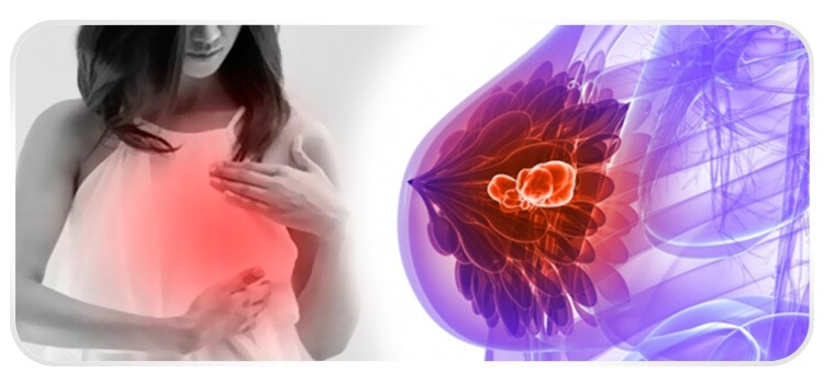 mulher a esquerda e a direita ilustracao de um nodulo na mama