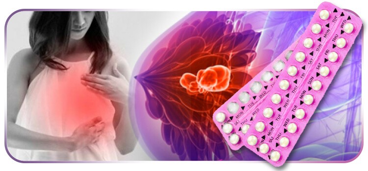 Anticoncepcional e o cancer de mama