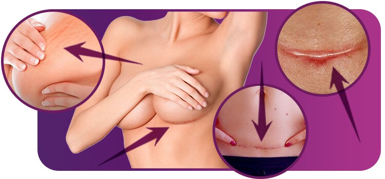 Saiba como fazer correção de cicatriz sem cirurgia
