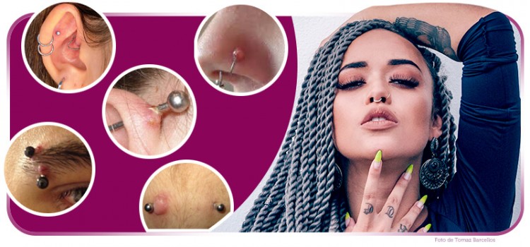 Descubra como evitar queloide no piercing