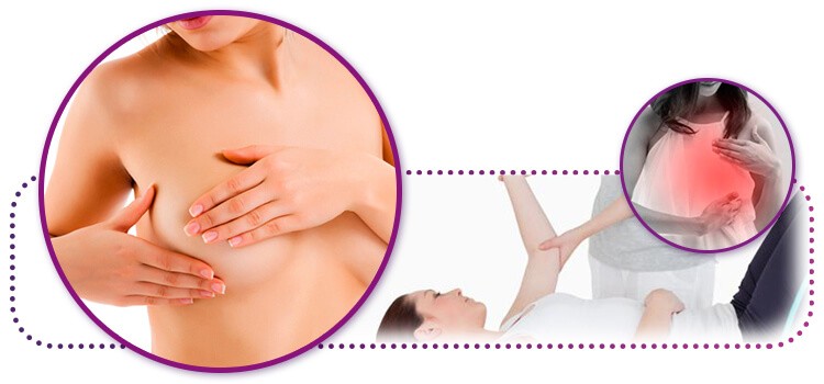 A Fisioterapia e o Câncer de Mama