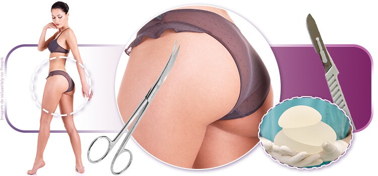 Implante de prótese glútea: o que você precisa saber sobre a cirurgia