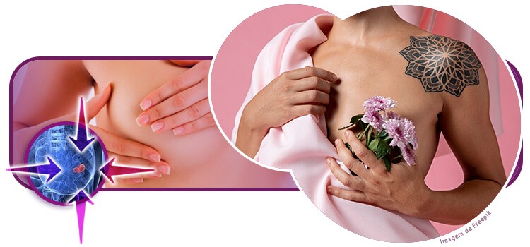 Saiba quais os principais cuidados após a mastectomia