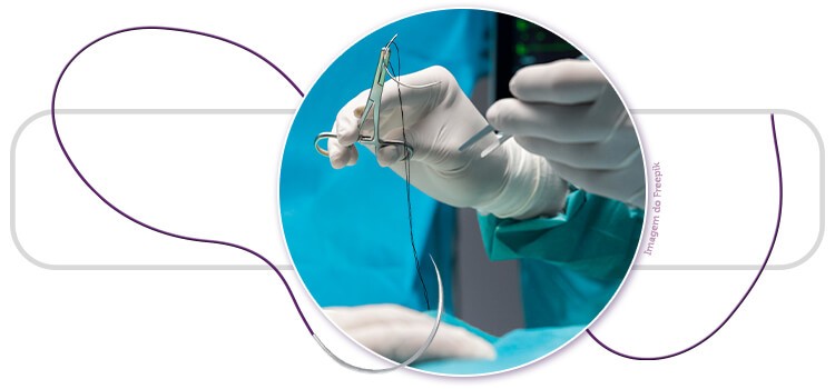 Procedimento com fio de sutura