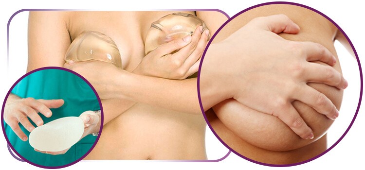 Como melhorar a autoestima: tudo sobre mamoplastia de aumento