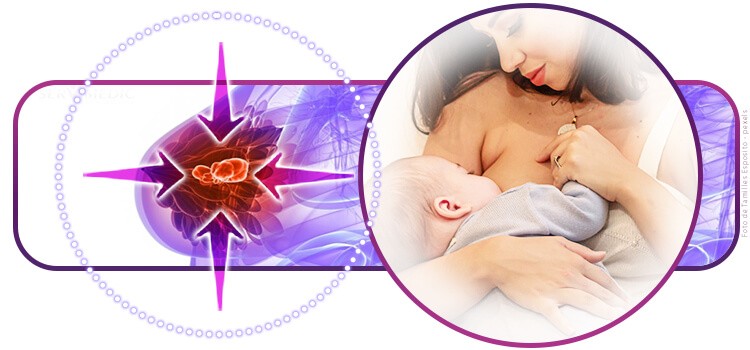 Amamentação como redução de risco do câncer de mama