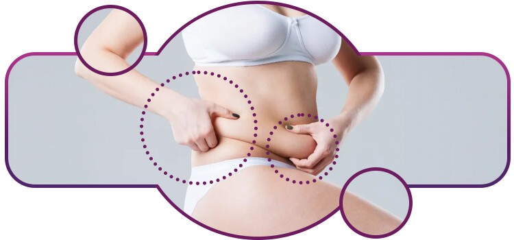 cirurgias para emagrecer