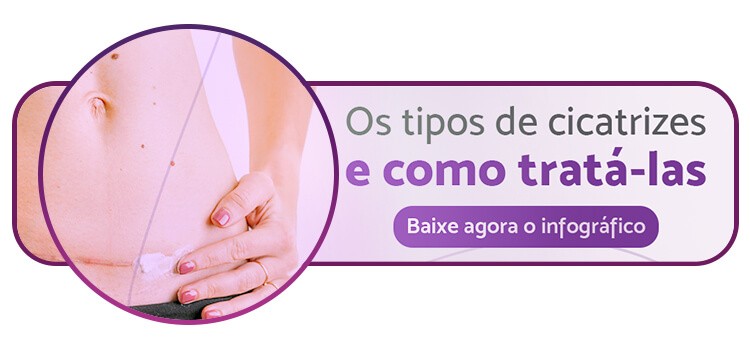 https://conteudo.servimedic.com.br/tipos-de-cicatrizes