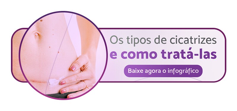 https://conteudo.servimedic.com.br/tipos-de-cicatrizes