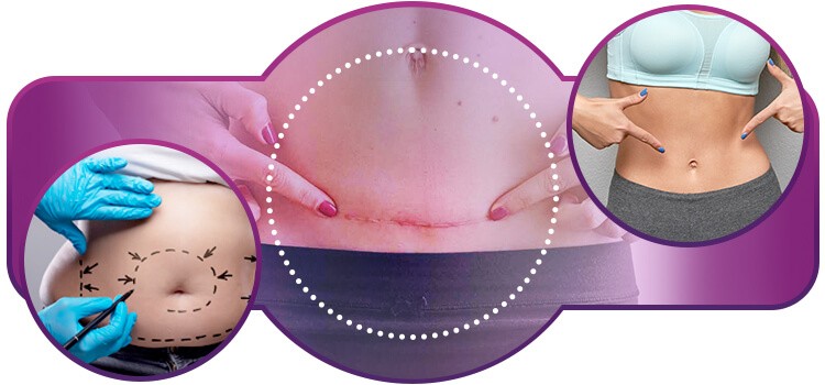 uso correto de cicatrizante