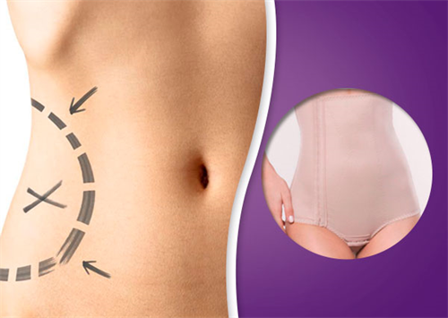 Benefícios da Utilização de Cinta Modeladora Pós Cirurgia Benefícios da Utilização de Cinta Modeladora Pós Cirurgia
